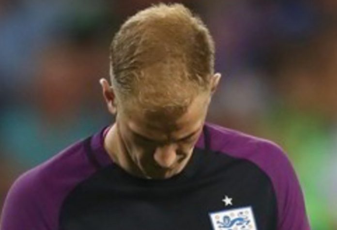 Joe Hart Joe Hart
