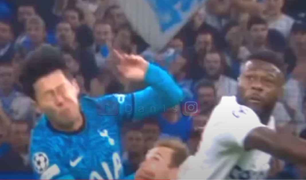 Operasi Sukses Son Heung-min Terbuka Membela Timnas Korea Selatan di Piala Dunia