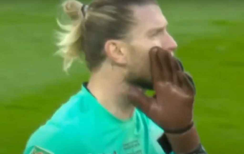 Newcastle Kalah, Sarung Tangan Karius Jadi Perhatian Fans