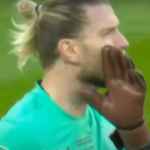 Newcastle Kalah, Sarung Tangan Karius Jadi Perhatian Fans