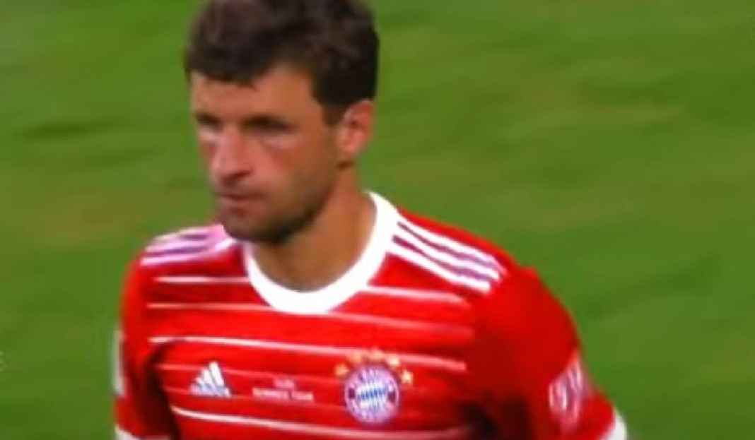 Thomas Muller Saat Memperkuat Laga Bayern Munchen Kejutan, Thomas Muller Ingin Hengkang dari Bayern Munchen!