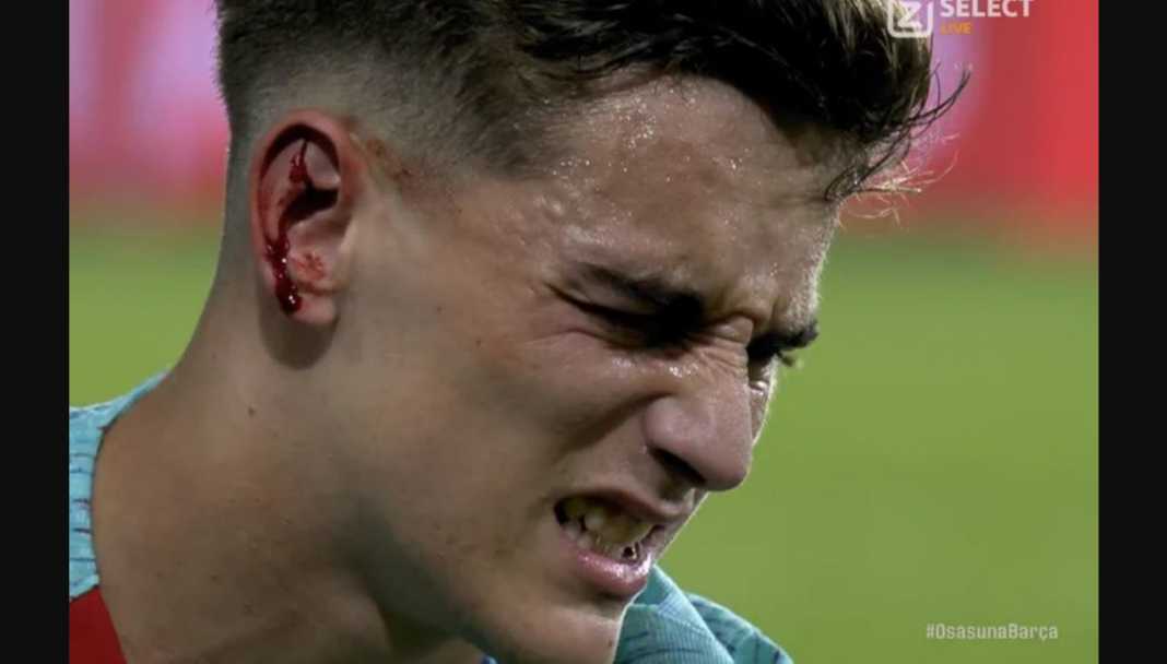 Cedera Gavi Mencuri Perhatian Dalam Kemenangan Barcelona di Osasuna