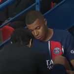 Kylian Mbappe saat mendapat perawatan usai cedera di laga PSG vs Marseille