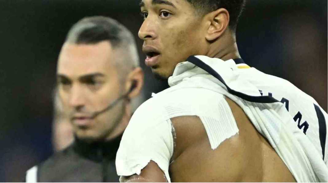 Jude Bellingham cedera bahu Real Madrid Langsung Gagal Mencetak Gol Begitu Bellingham Cedera