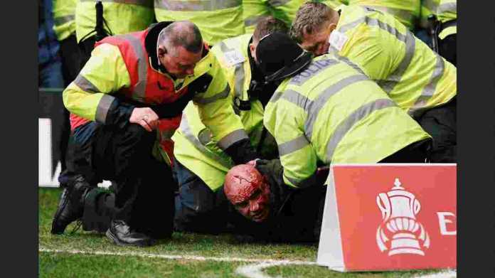 Korban kerusuhan di The Hawthorns 10 menit jelang berakhirnya laga West Brom vs Wolves