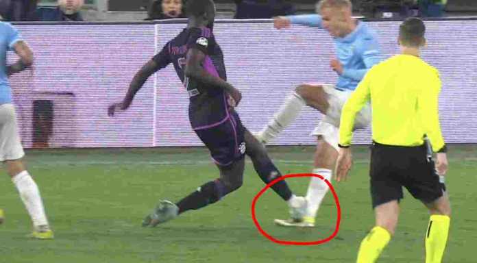 Dayot Upamecano menginjak kaki satu pemain Lazio berujung kartu merah