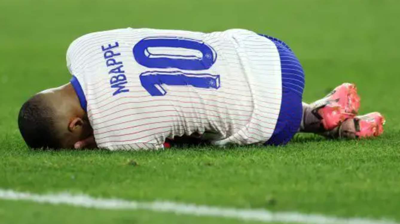Hidung Kylian Mbappe cedera di pertandingan Austria vs Prancis di Euro 2024