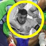 Hidung Kylian Mbappe patah dan tampak bengkok