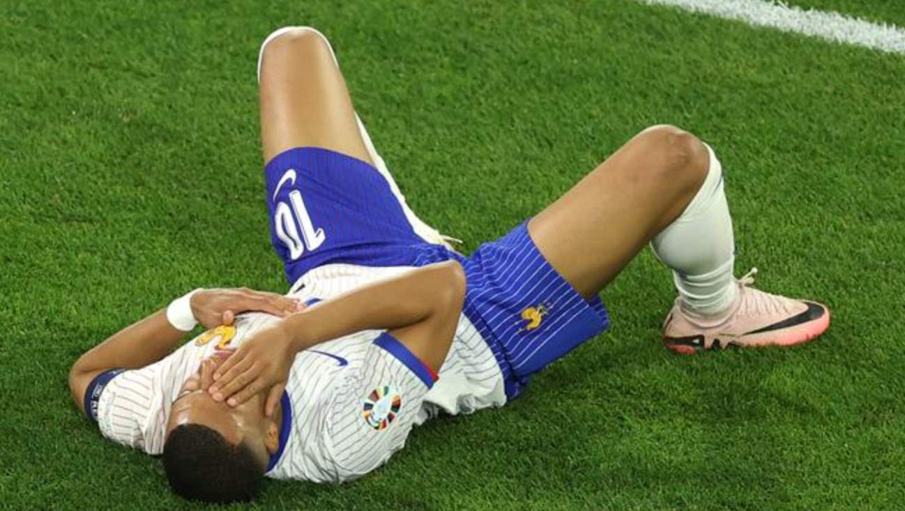 Kylian Mbappe cedera di pertandingan Austria vs Prancis di Euro 2024