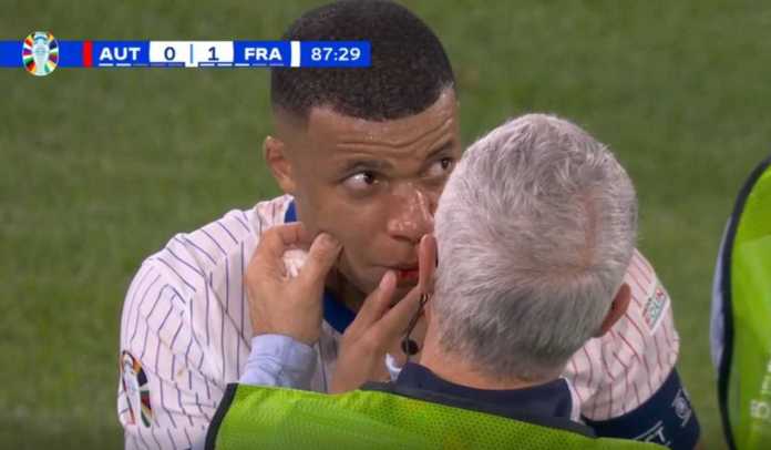 Kylian Mbappe Bakal Kenakan Topeng Pelindung di Euro 2024 Usai Mengalami Patah Hidung