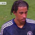 Dua Alasan Mengapa Manchester United Sempat Rahasiakan Tingkat Cedera Leny Yoro