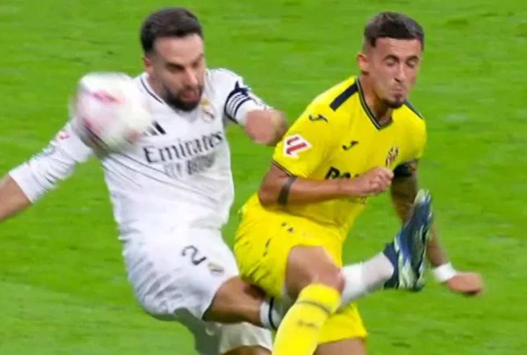 Dani Carvajal cedera parah di laga Real Madrid vs Villarreal