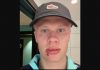 Erling Haaland pemain Manchester City luka kena pintu bus