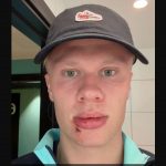 Erling Haaland pemain Manchester City luka kena pintu bus