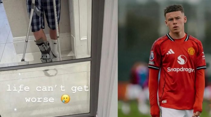 Kai Rooney pemain Manchester United U16 cedera Kai Rooney pemain Manchester United U16 cedera